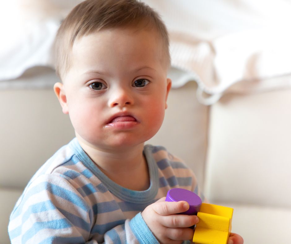 تأهيل أطفال متلازمة داون مصر